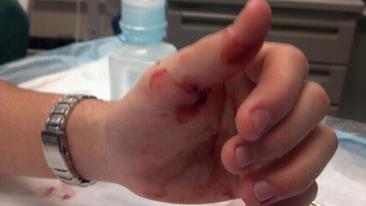 The hand.