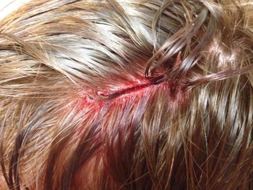 Ouch.
