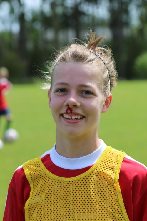 Adrianne Gribble smiles through the pain after taking a shot in warmups.