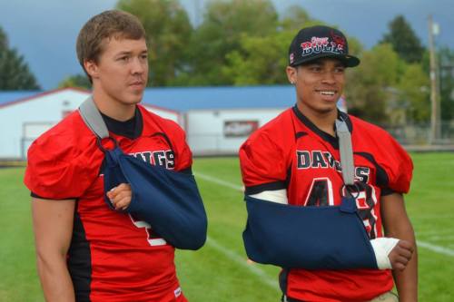 Mitch Pelroy (right) and Montana Western teammate ? compare arm slings. (Haylee Sauer photo)