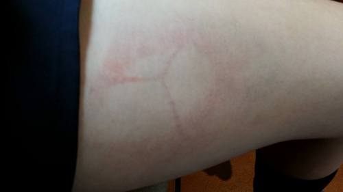 Mia Littlejohn carries a reminder of the soccer ball she stopped while scrimmaging against a boy's squad. (Dawn Hesselgrave photos)